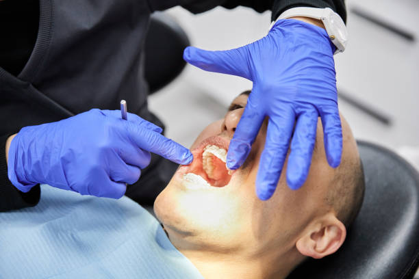 Best Emergency Wisdom Teeth Removal in Lake Sherwood, CA